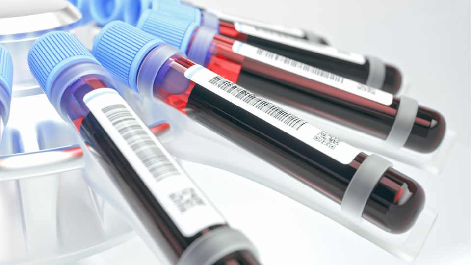 New Legal Framework on Human Biological Material in Cameroon